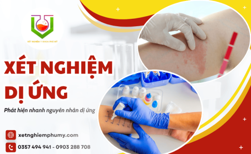 Dịch vụ xét nghiệm dị ứng chuẩn xác - Phát hiện ngay nguyên nhân dị ứng