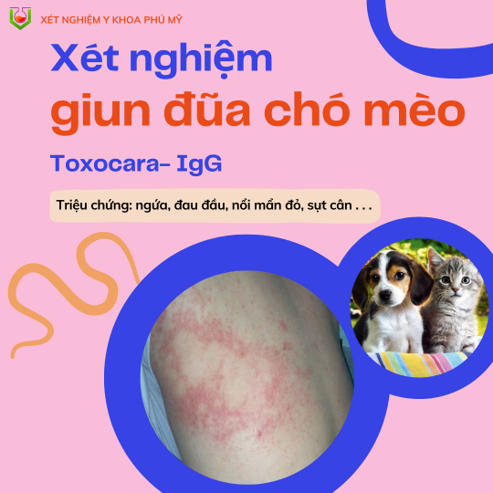 Xét nghiệm Giun đũa chó mèo- Toxocara  IgG