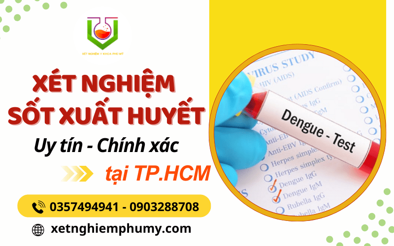 xét nghiệm sốt xuất huyết