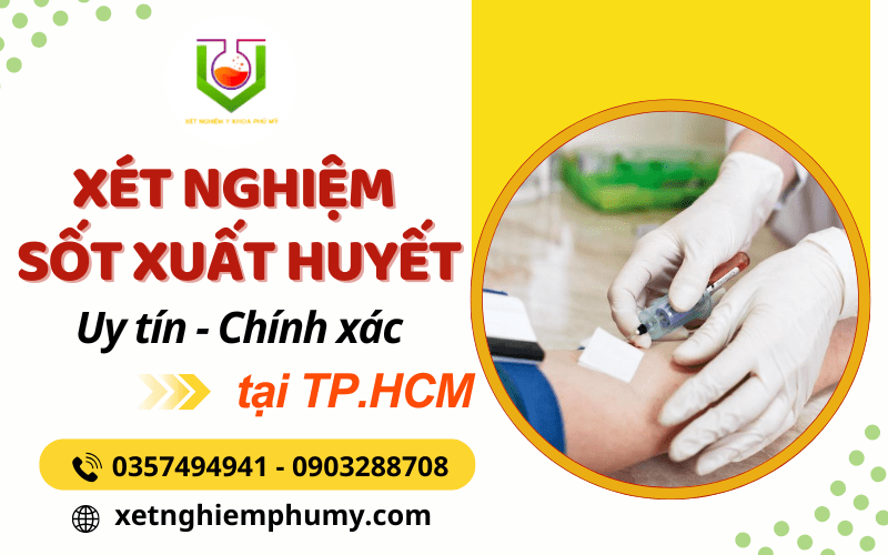 xét nghiệm sốt xuất huyết
