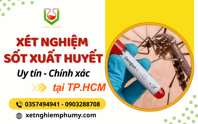 xét nghiệm sốt xuất huyết