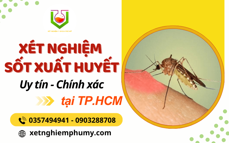 xét nghiệm sốt xuất huyết