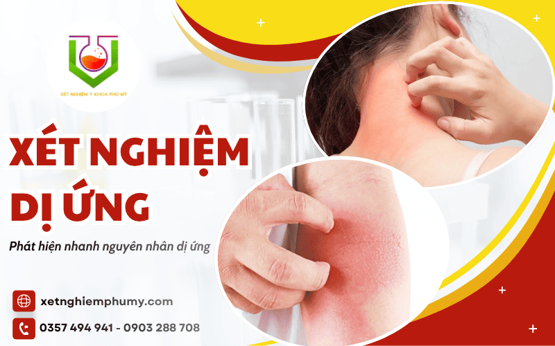 xét nghiệm dị ứng