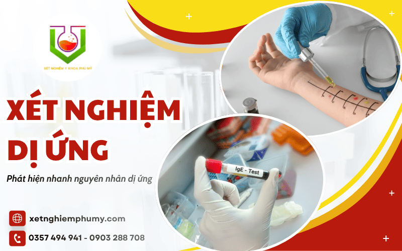 xét nghiệm dị ứng