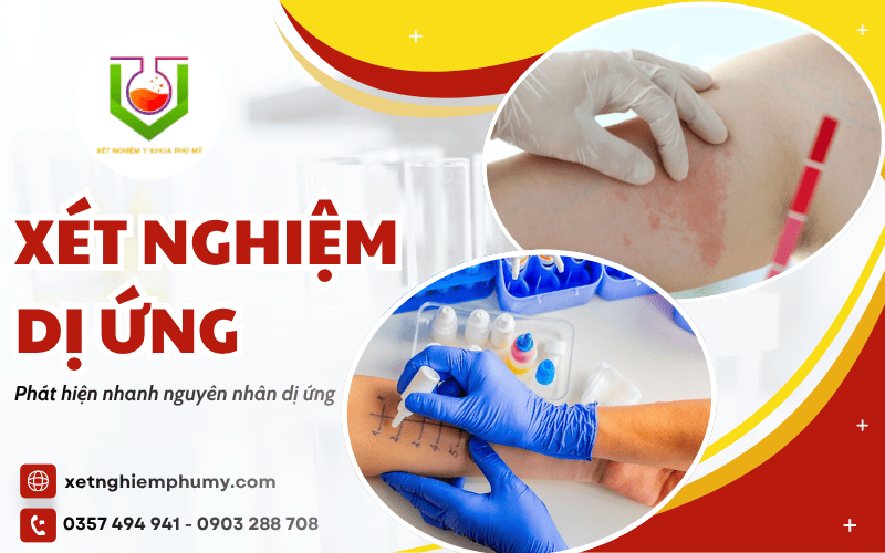 xét nghiệm dị ứng