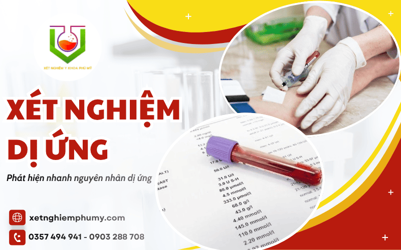 xét nghiệm dị ứng