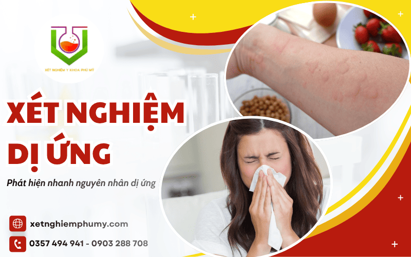 xét nghiệm dị ứng