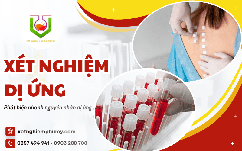 xét nghiệm dị ứng